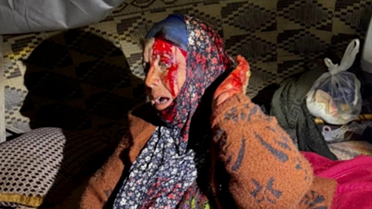 An elderly Palestinian victim of the September 2025 Khallit al-Dabe' 'pogrom'